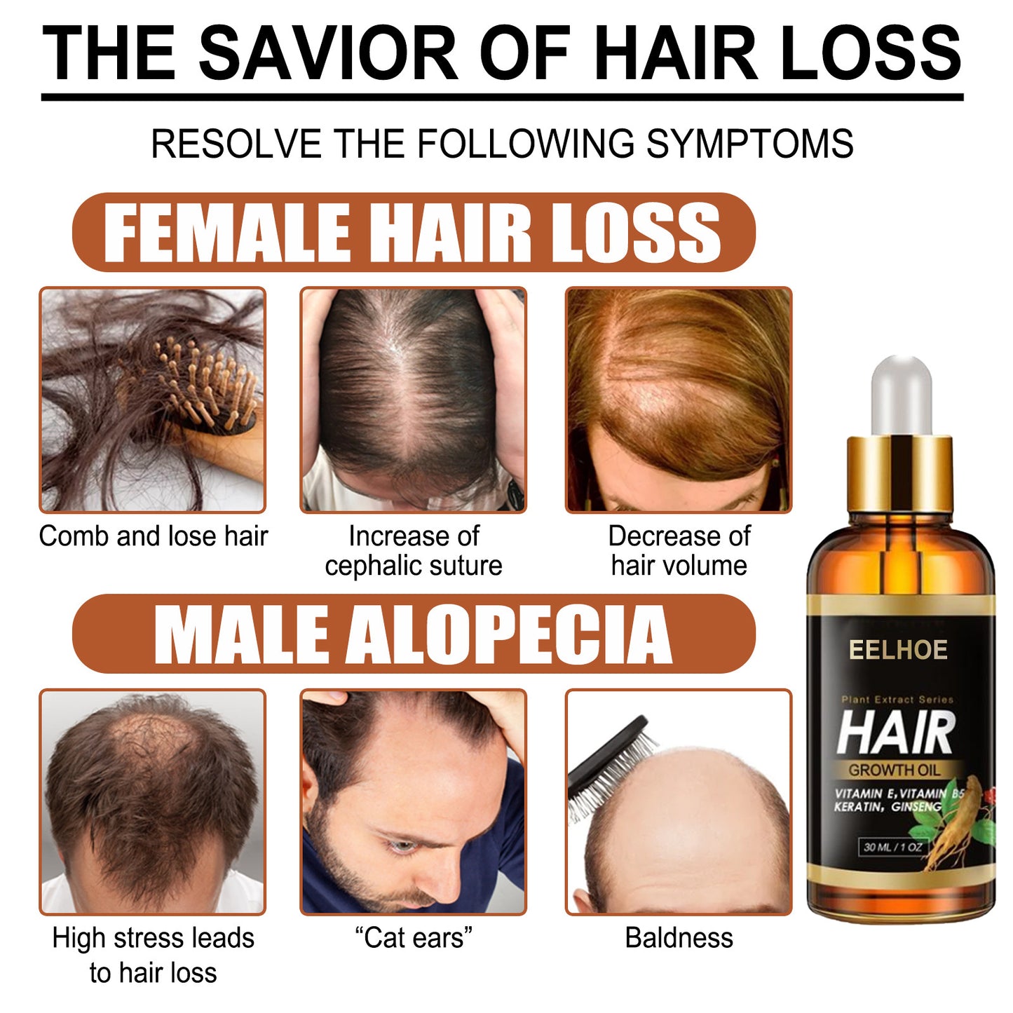 Elecsop Hair Growth Oil, Biotin Hair Growth Serum Hair Loss Treatment for Thicker Longer Healthier Hair, Promotes Hair Regrowth, Prevent Thinning Hair