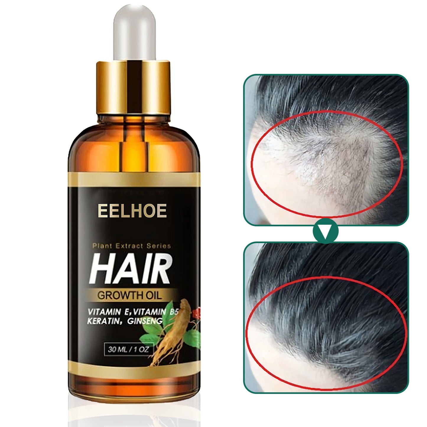 Elecsop Hair Growth Oil, Biotin Hair Growth Serum Hair Loss Treatment for Promotes Hair Regrowth, Prevent Thinning Hair