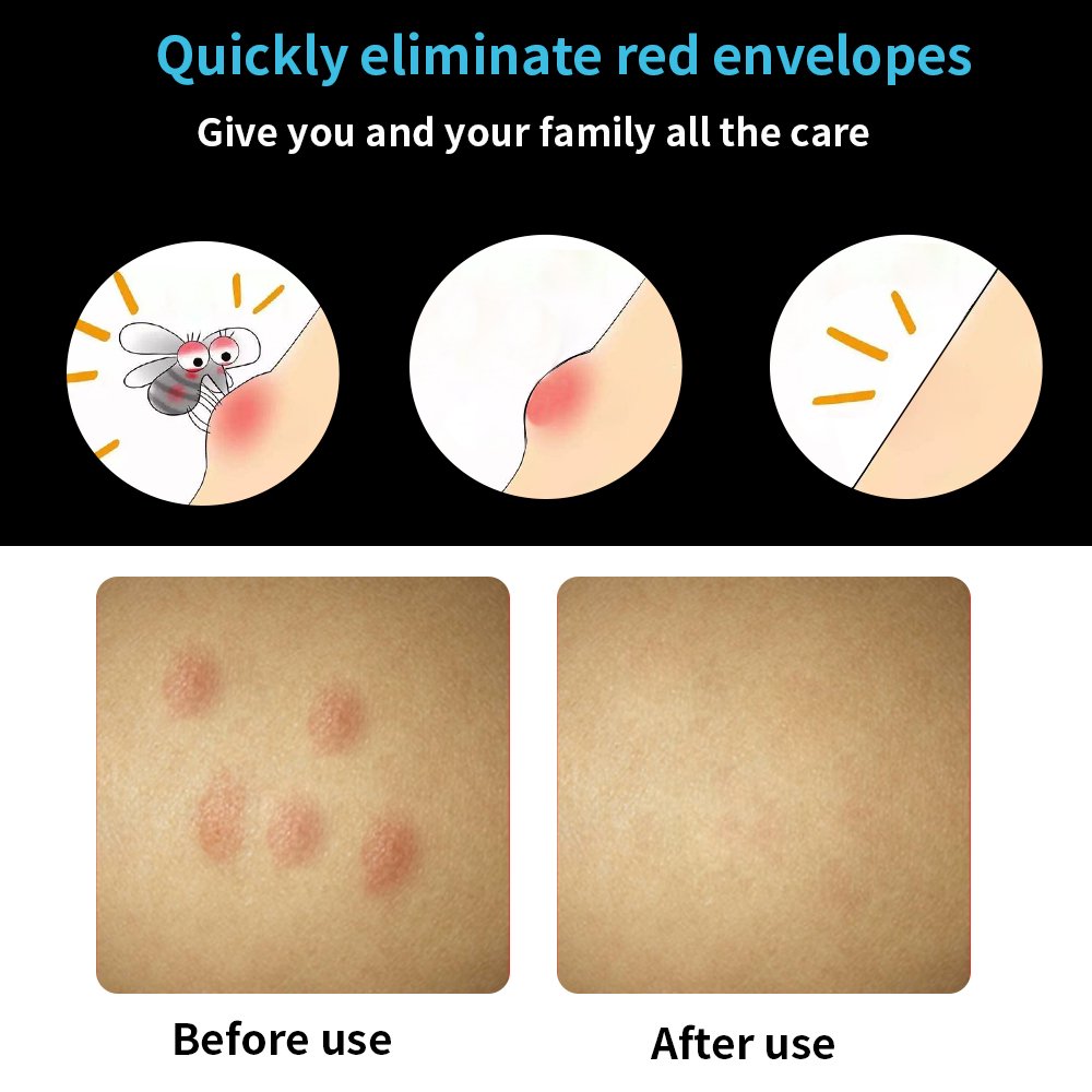 2 Pack Insect Sting and Bite Relief, Chemical-Free Treatment, Fast Symptom Relief, Reduce Pain & Itching, No Odor or Residue