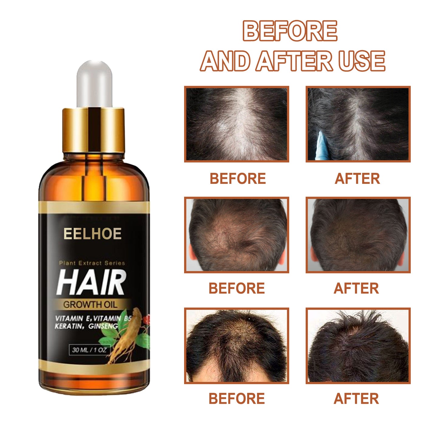 Elecsop Hair Growth Oil, Biotin Hair Growth Serum Hair Loss Treatment for Thicker Longer Healthier Hair, Promotes Hair Regrowth, Prevent Thinning Hair