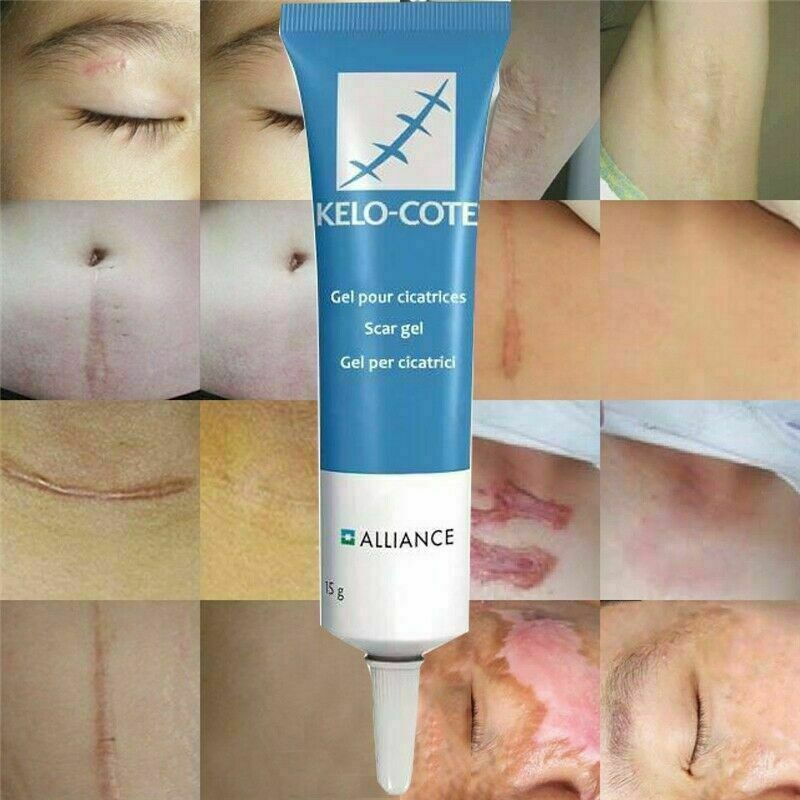 4PCS Scar Gel Medical-Grade Professional Advanced Scar Removal gel, for Face, Body, Surgical, Burn, Hypertrophic Scars, 18 Month Supply