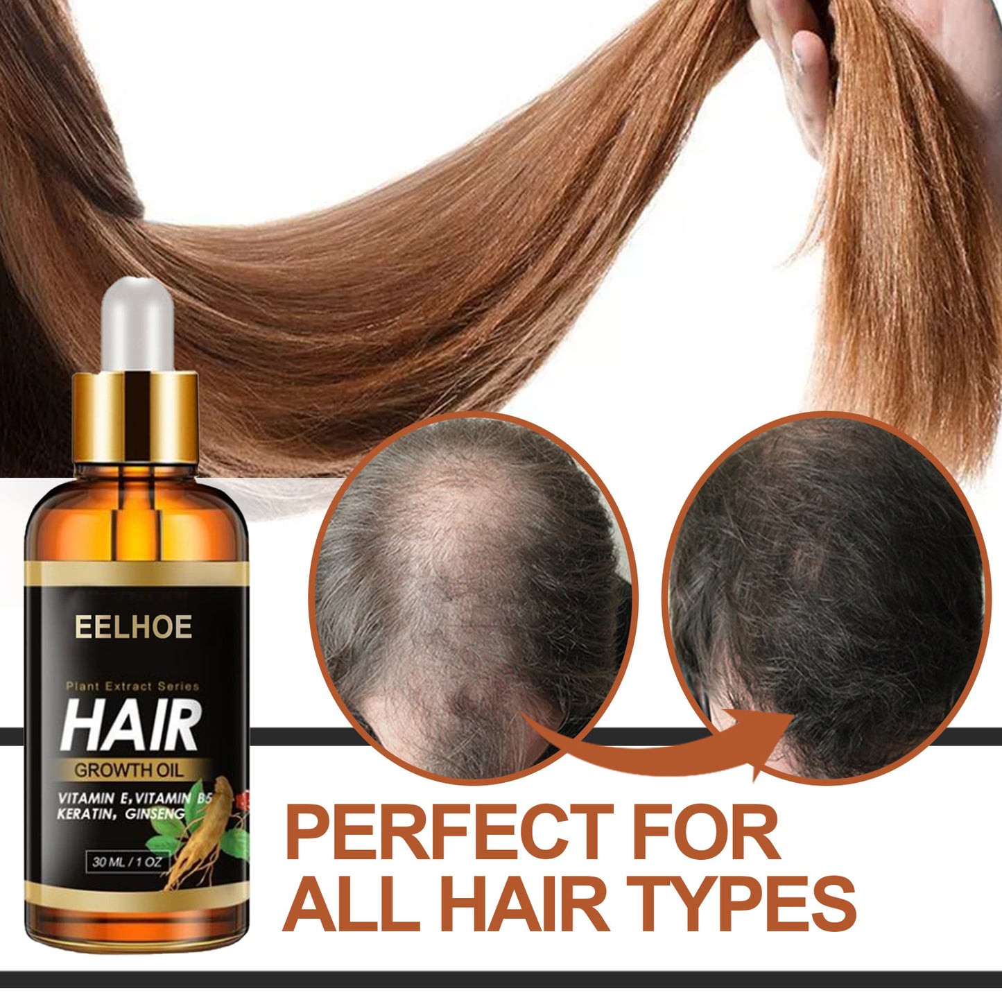 Elecsop Hair Growth Oil, Biotin Hair Growth Serum Hair Loss Treatment for Thicker Longer Healthier Hair, Promotes Hair Regrowth, Prevent Thinning Hair