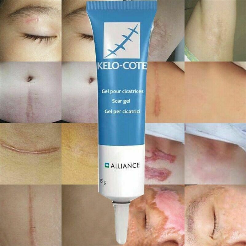 4Pack Powerful Kelo Cote Topical Advanced Formula Scar Gel Eliminate Scars - 15Gm by