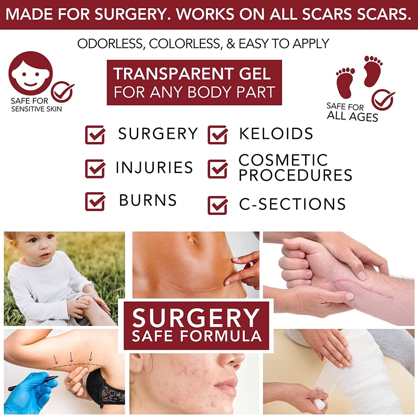 4Pack Powerful Kelo Cote Topical Advanced Formula Scar Gel Eliminate Scars - 15Gm by