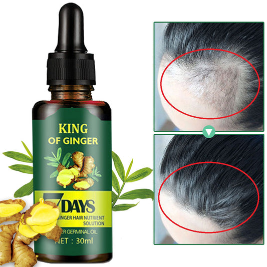 Elecsop Regrow Ginger Germinal Hair Growth Serum Hairdressing Oil Loss Treatment - 2022 upgrade