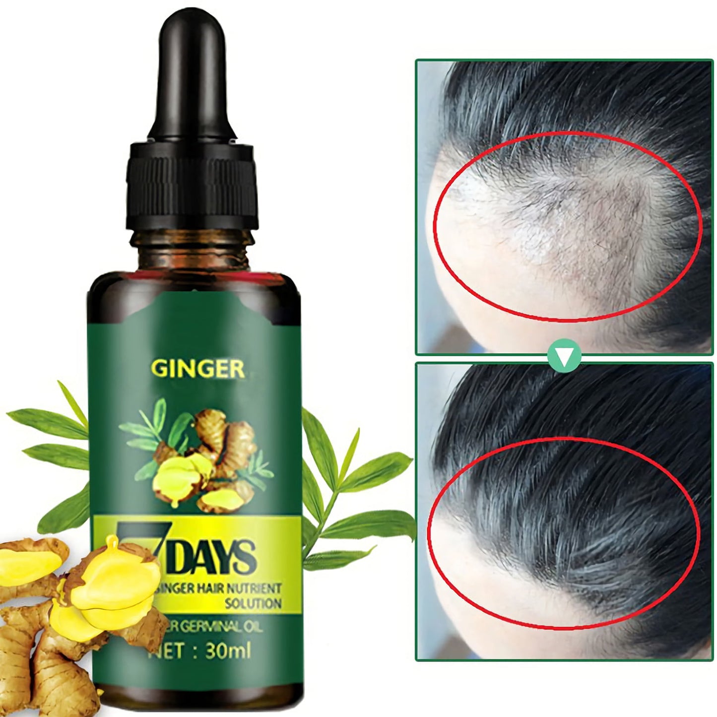 Elecsop Regrow Ginger Germinal Hair Growth Serum Hairdressing Oil Loss Treatment - 2022 Upgrade