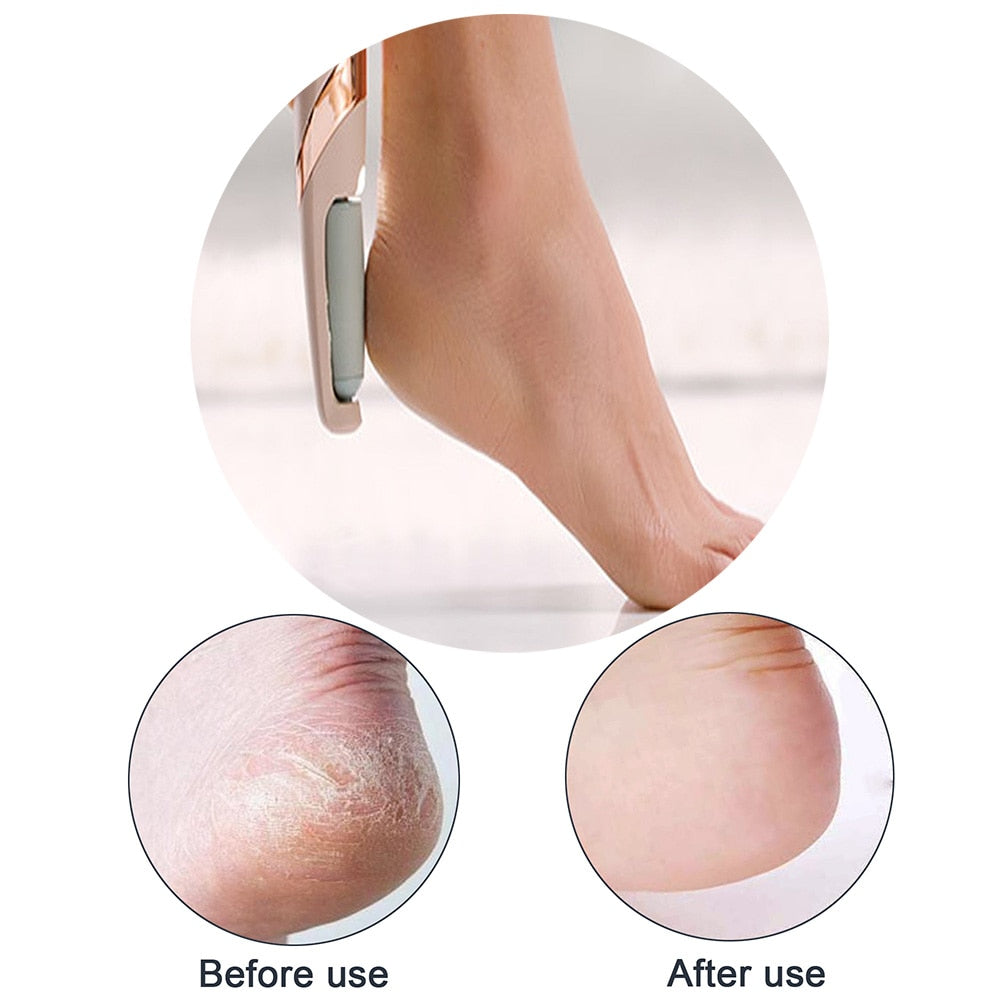 SPBPQY Callus Remover for Feet Pedi Electronic Tool File Remover Pedicure Pedi Spin Tool